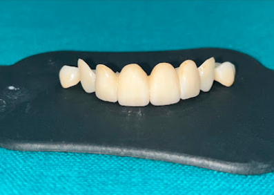 Custom Zirconia Ceramic Crown & Bridge Unit